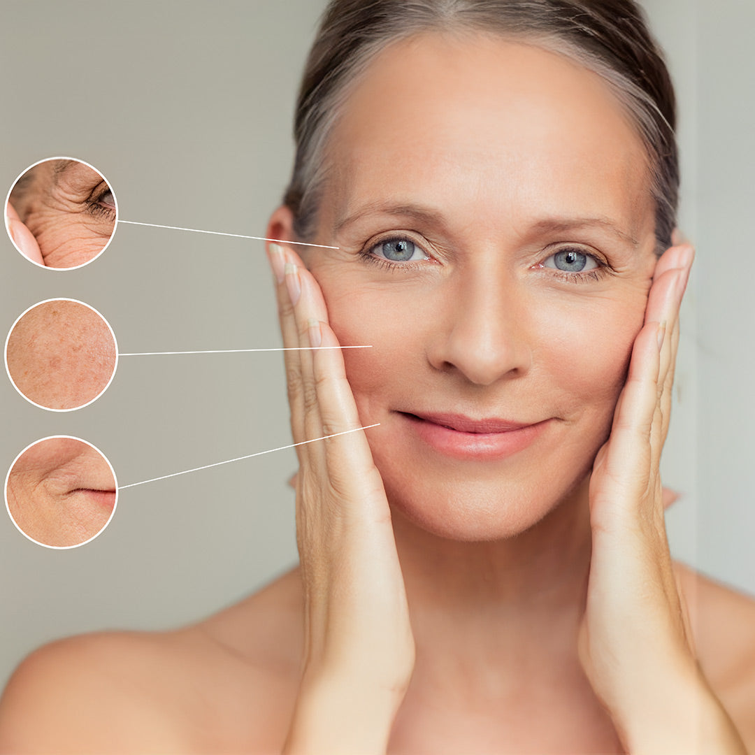 Woman showing early signs of aging skin such as wrinkles, dark spots, and fine lines, related to ayurvedic skincare for aging skin.