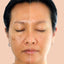 Ayurvedic Remedies for Hyperpigmentation: Fade Dark Spots